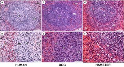 Histological Disorganization of Spleen Compartments and Severe Visceral Leishmaniasis